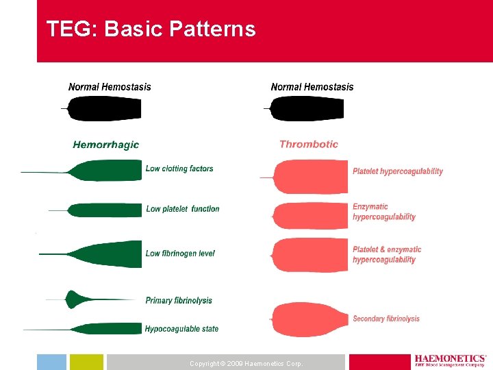 TEG: Basic Patterns Copyright © 2009 Haemonetics Corp. 