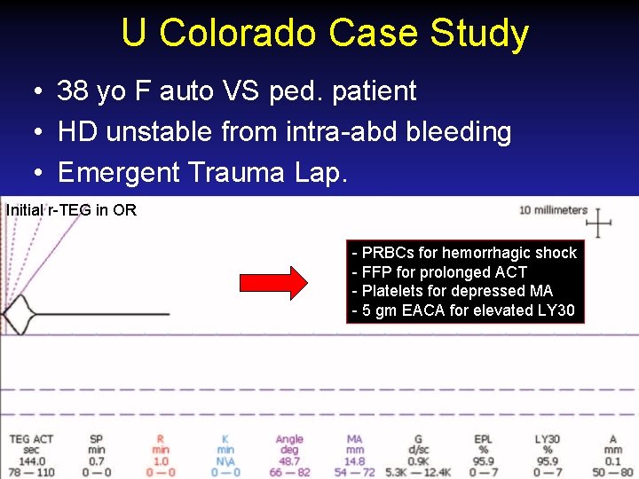 U Colorado Case Study • 38 yo F auto VS ped. patient • HD