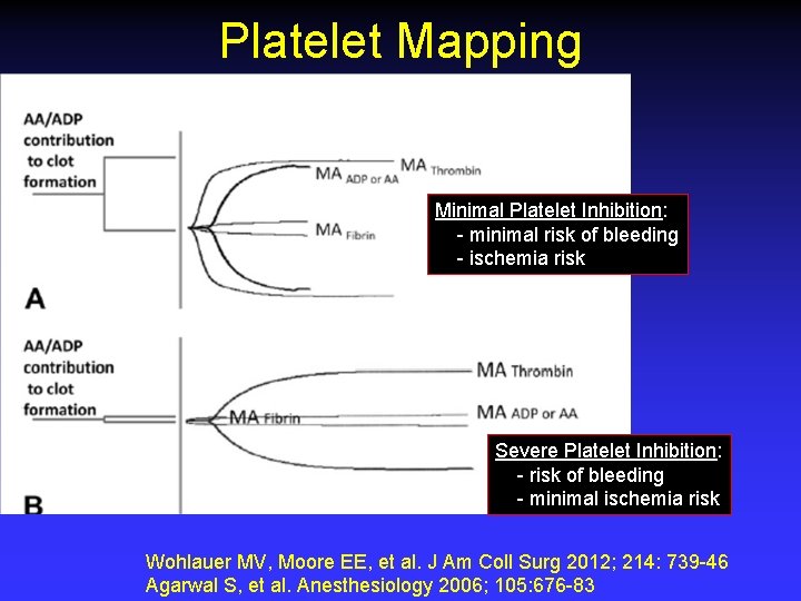 Platelet Mapping Minimal Platelet Inhibition: - minimal risk of bleeding - ischemia risk Severe