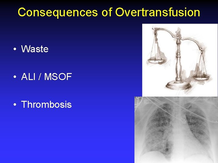 Consequences of Overtransfusion • Waste • ALI / MSOF • Thrombosis 