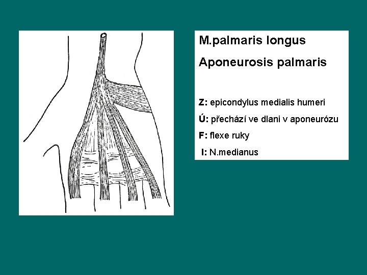 M. palmaris longus Aponeurosis palmaris Z: epicondylus medialis humeri Ú: přechází ve dlani v