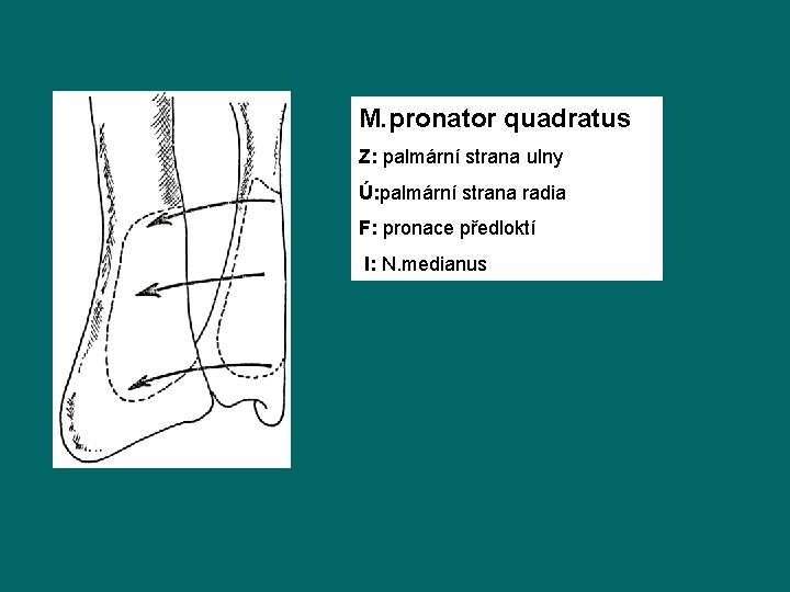 M. pronator quadratus Z: palmární strana ulny Ú: palmární strana radia F: pronace předloktí