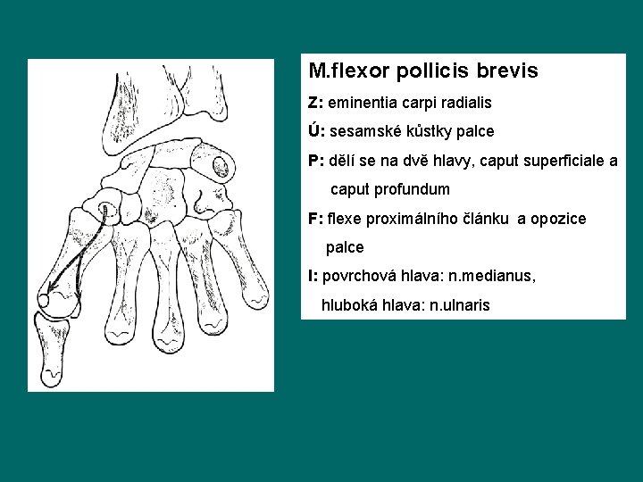 M. flexor pollicis brevis Z: eminentia carpi radialis Ú: sesamské kůstky palce P: dělí