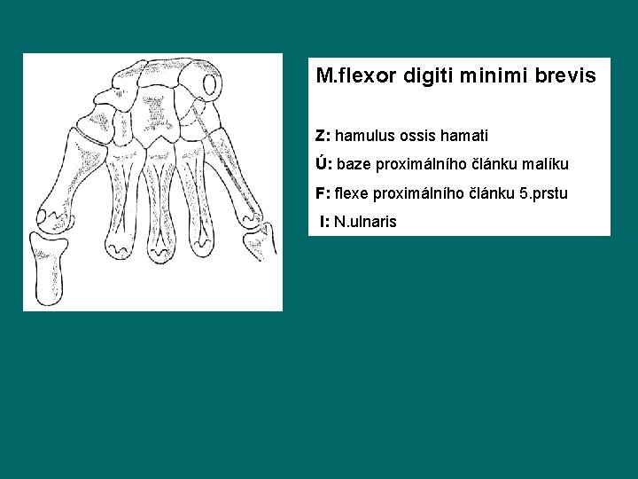 M. flexor digiti minimi brevis Z: hamulus ossis hamati Ú: baze proximálního článku malíku