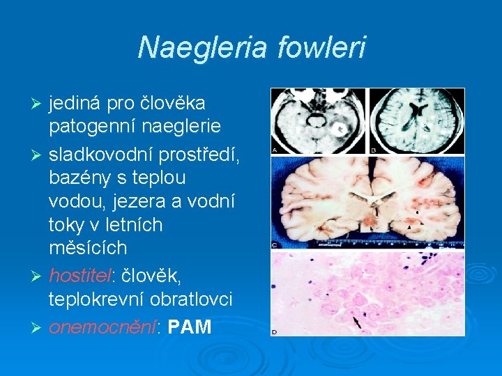 Naegleria fowleri jediná pro člověka patogenní naeglerie Ø sladkovodní prostředí, bazény s teplou vodou,