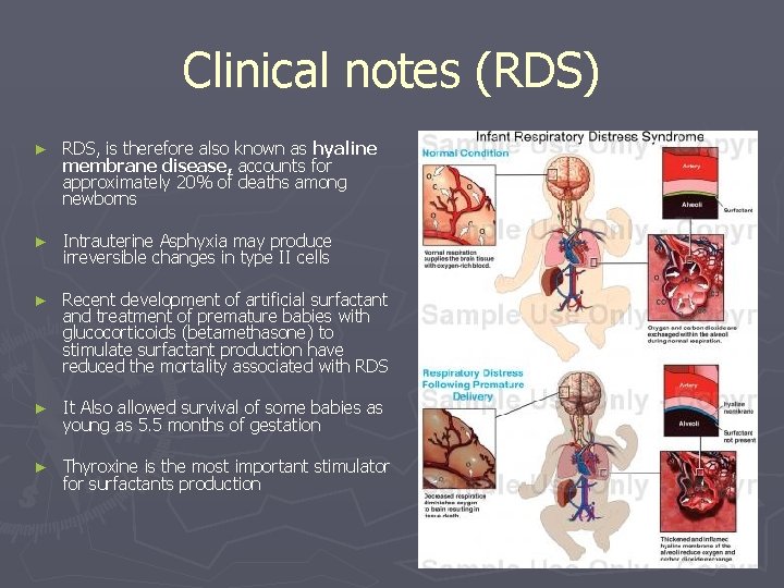 Clinical notes (RDS) ► RDS, is therefore also known as hyaline membrane disease, accounts