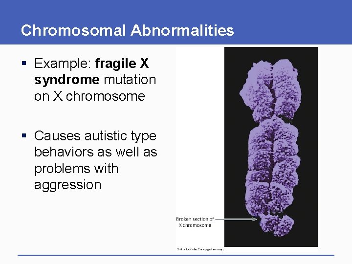 Chromosomal Abnormalities § Example: fragile X syndrome mutation on X chromosome § Causes autistic