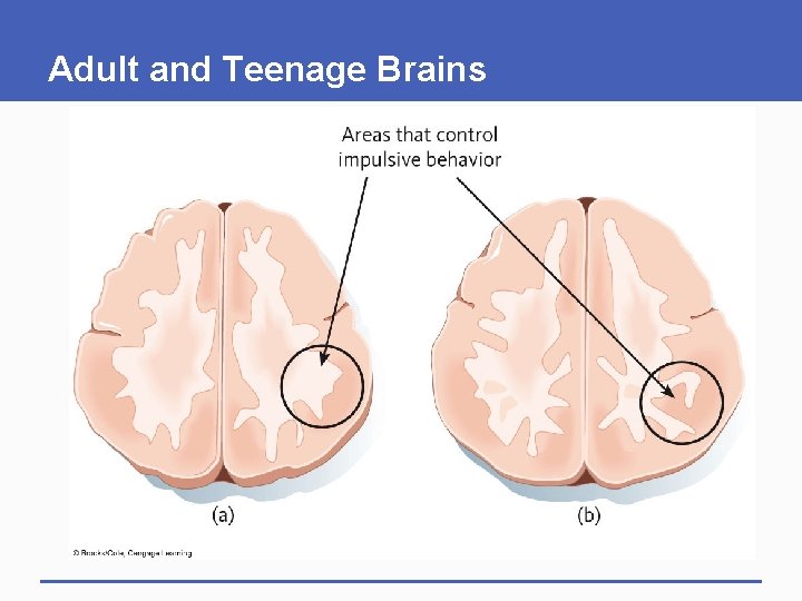 Adult and Teenage Brains 