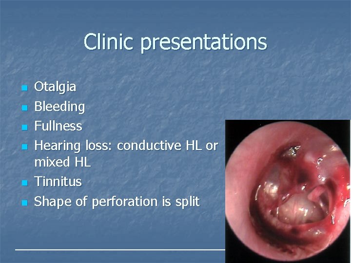 Clinic presentations n n n Otalgia Bleeding Fullness Hearing loss: conductive HL or mixed