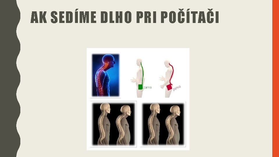 AK SEDÍME DLHO PRI POČÍTAČI 