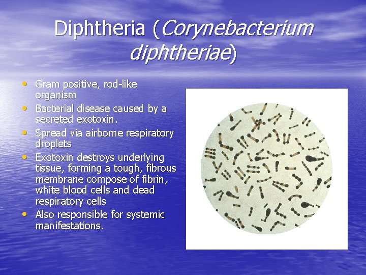 Diphtheria (Corynebacterium diphtheriae) • Gram positive, rod-like • • organism Bacterial disease caused by