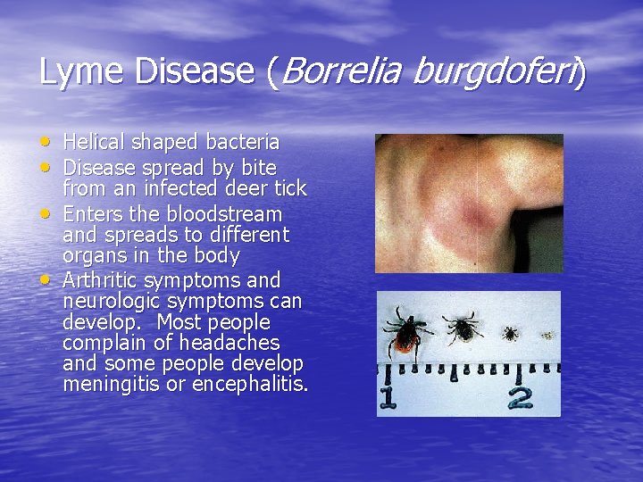 Lyme Disease (Borrelia burgdoferi) • Helical shaped bacteria • Disease spread by bite •