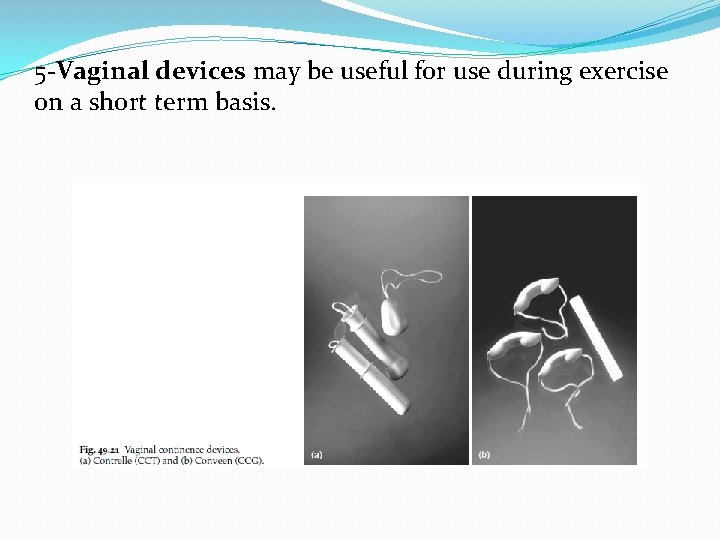 5 -Vaginal devices may be useful for use during exercise on a short term