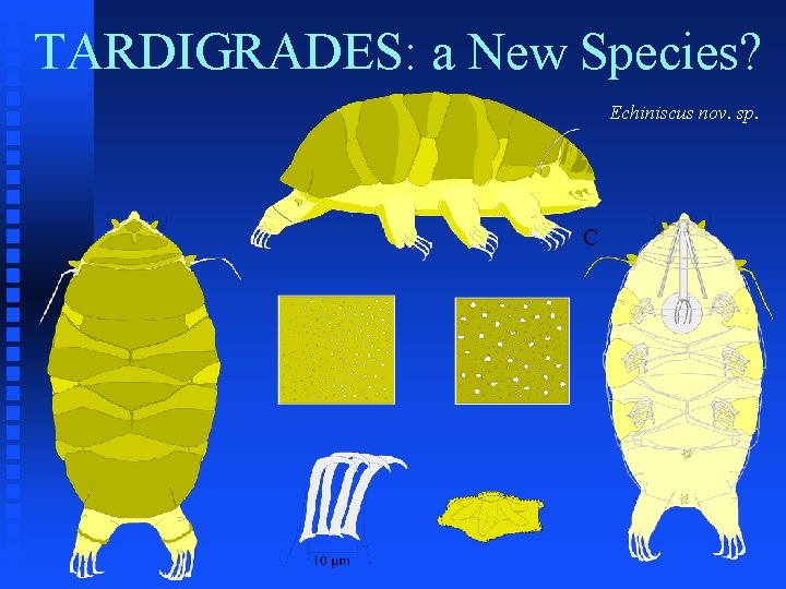 TARDIGRADES: a New Species? Echiniscus nov. sp. 