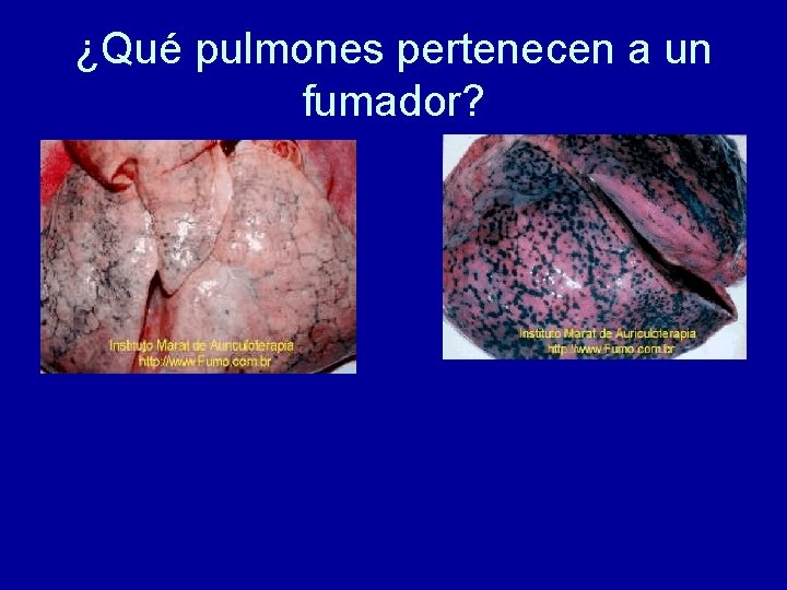 ¿Qué pulmones pertenecen a un fumador? 