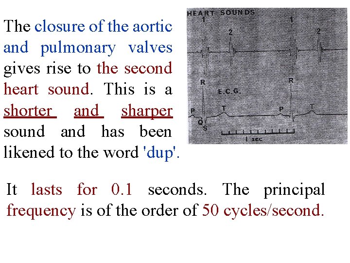 The closure of the aortic and pulmonary valves gives rise to the second heart