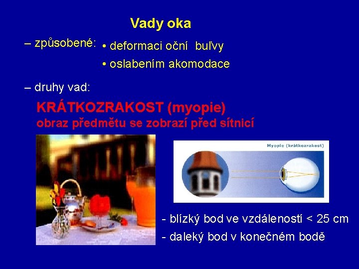 Vady oka – způsobené: • deformaci oční buľvy • oslabením akomodace – druhy vad: