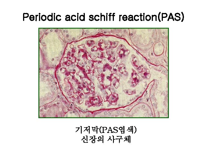 Periodic acid schiff reaction(PAS) 기저막(PAS염색) 신장의 사구체 