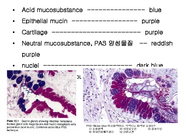  • Acid mucosubstance -------- blue • Epithelial mucin --------- purple • Cartilage ------------