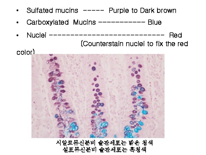  • Sulfated mucins ----- Purple to Dark brown • Carboxylated Mucins ------ Blue