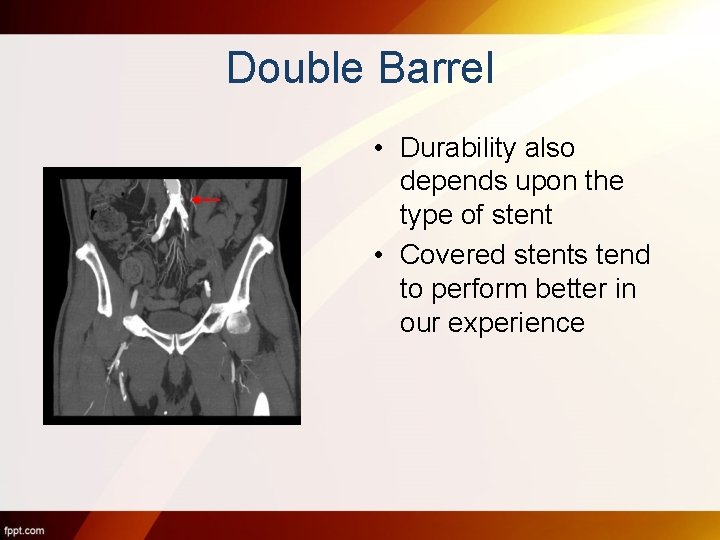 Double Barrel • Durability also depends upon the type of stent • Covered stents