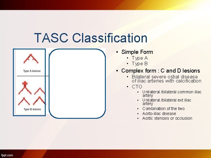 TASC Classification • Simple Form • Type A • Type B • Complex form