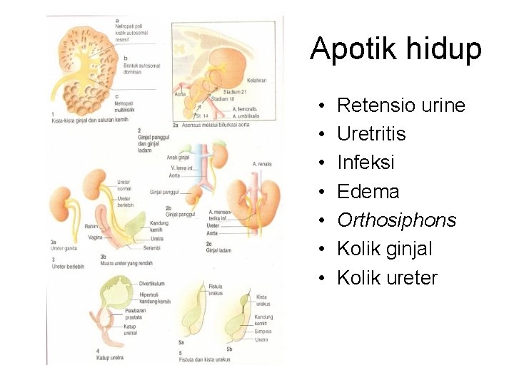 Apotik hidup • • Retensio urine Uretritis Infeksi Edema Orthosiphons Kolik ginjal Kolik ureter