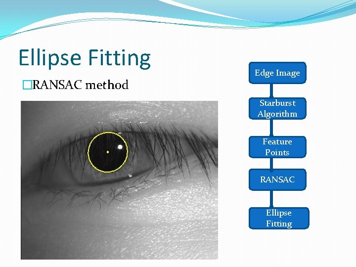 Ellipse Fitting �RANSAC method Edge Image Starburst Algorithm Feature Points RANSAC Ellipse Fitting 