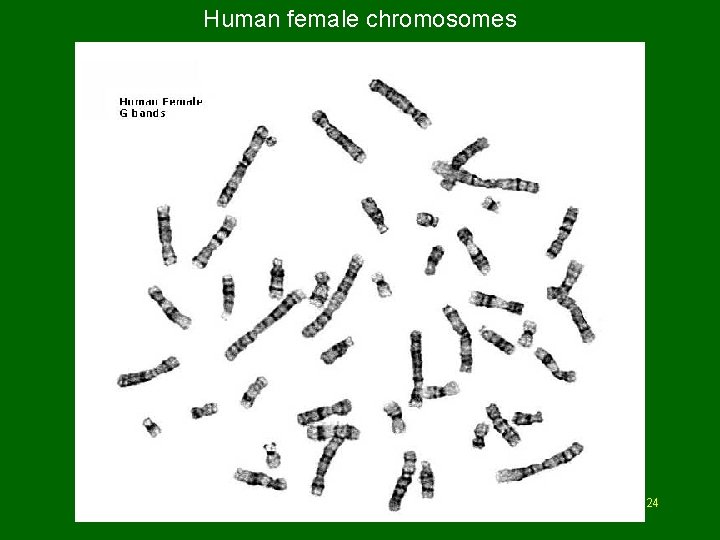 Human female chromosomes Hillaby - Biology 30 - 2009 124  Human female chromosomes Hillaby - Biology 30 - 2009 124