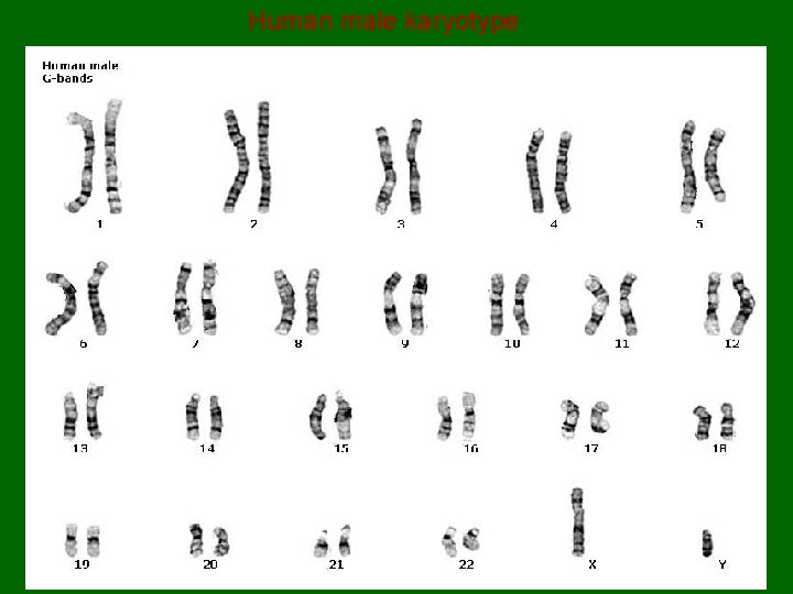 Human male karyotype Hillaby - Biology 30 - 2009 127  Human male karyotype Hillaby - Biology 30 - 2009 127