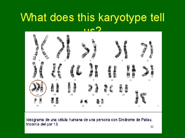 What does this karyotype tell us?  What does this karyotype tell us?