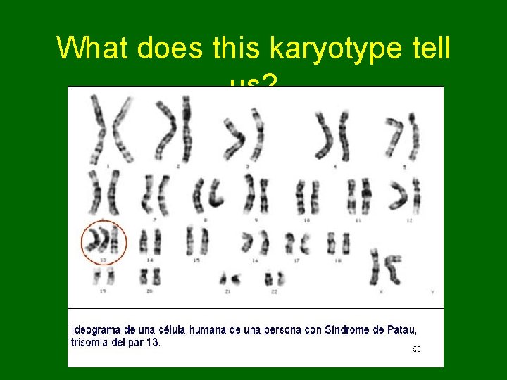 What does this karyotype tell us? 