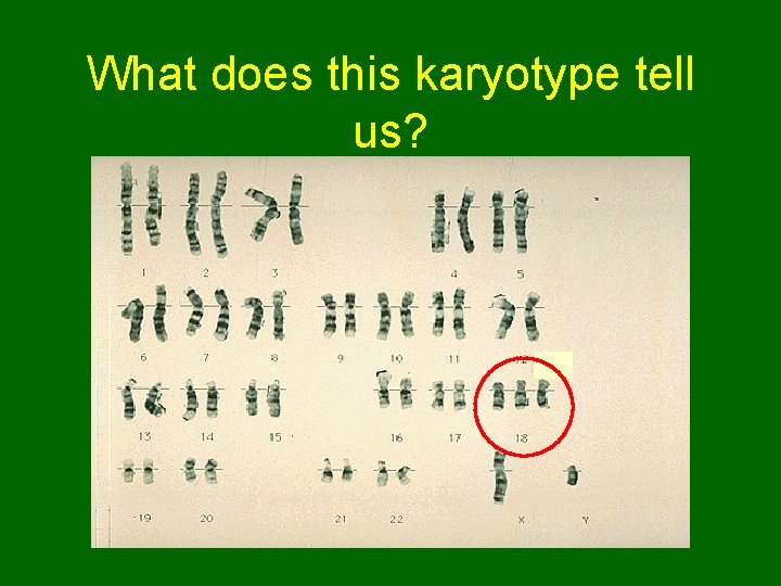 What does this karyotype tell us?  What does this karyotype tell us?