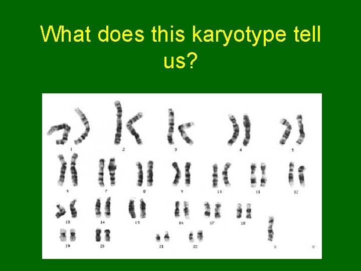 What does this karyotype tell us? 