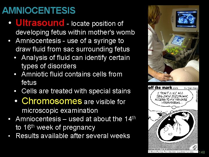 AMNIOCENTESIS • Ultrasound - locate position of developing fetus within mother's womb • Amniocentesis