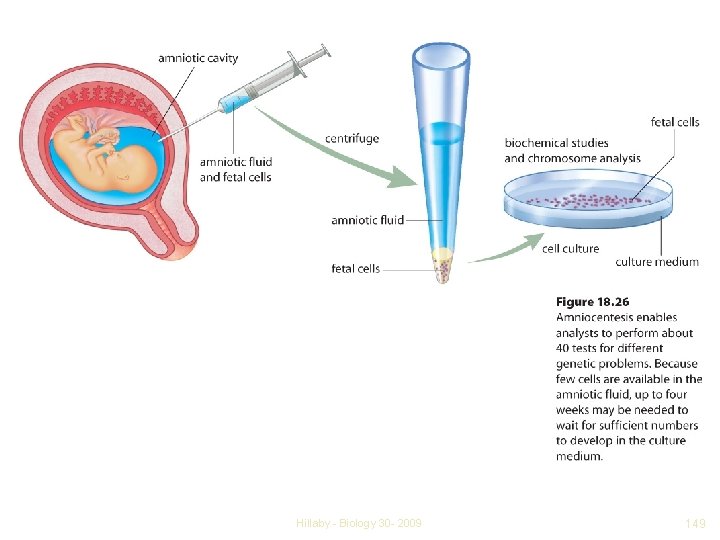 Hillaby - Biology 30 - 2009 149 