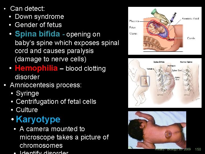 • Can detect: • Down syndrome • Gender of fetus • Spina bifida  • Can detect: • Down syndrome • Gender of fetus • Spina bifida