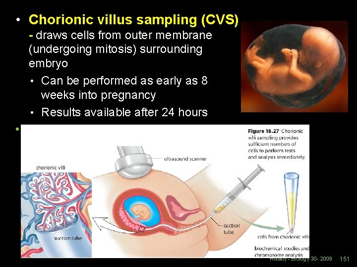  • Chorionic villus sampling (CVS) - draws cells from outer membrane (undergoing mitosis)