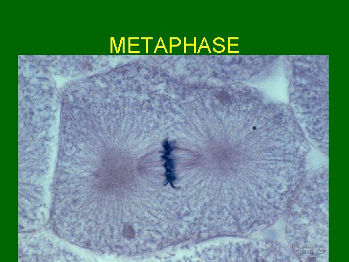 METAPHASE 