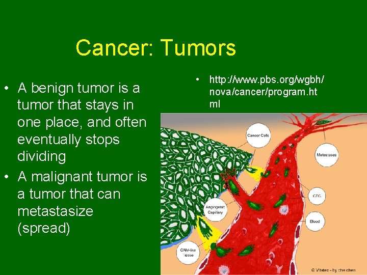 Cancer: Tumors • A benign tumor is a tumor that stays in one place,