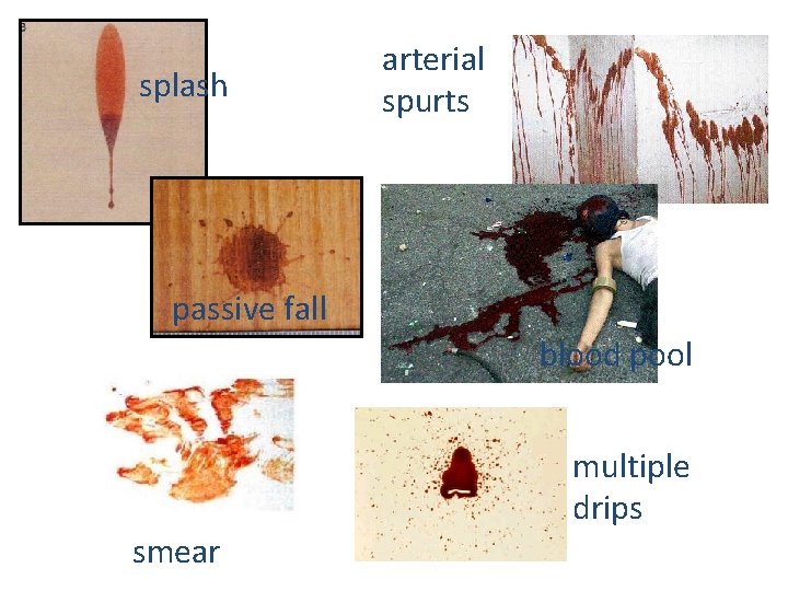 splash arterial spurts passive fall blood pool multiple drips smear 