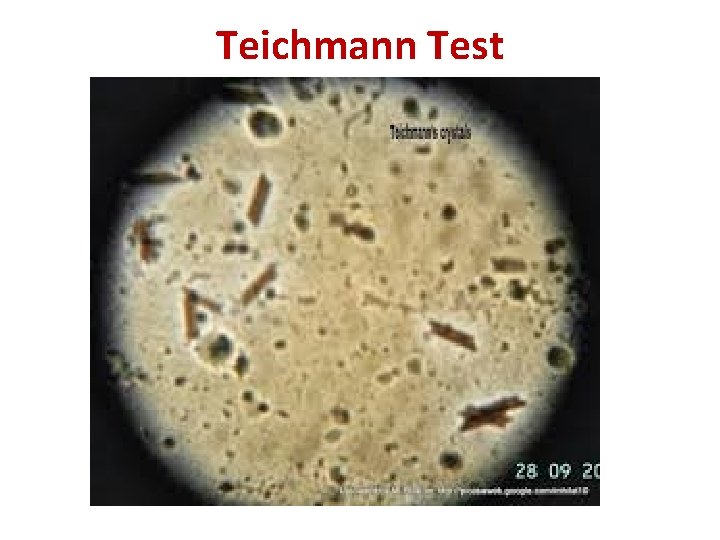 Teichmann Test 