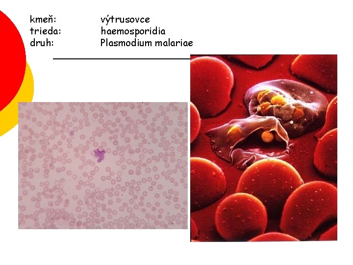 kmeň: trieda: druh: výtrusovce haemosporidia Plasmodium malariae 