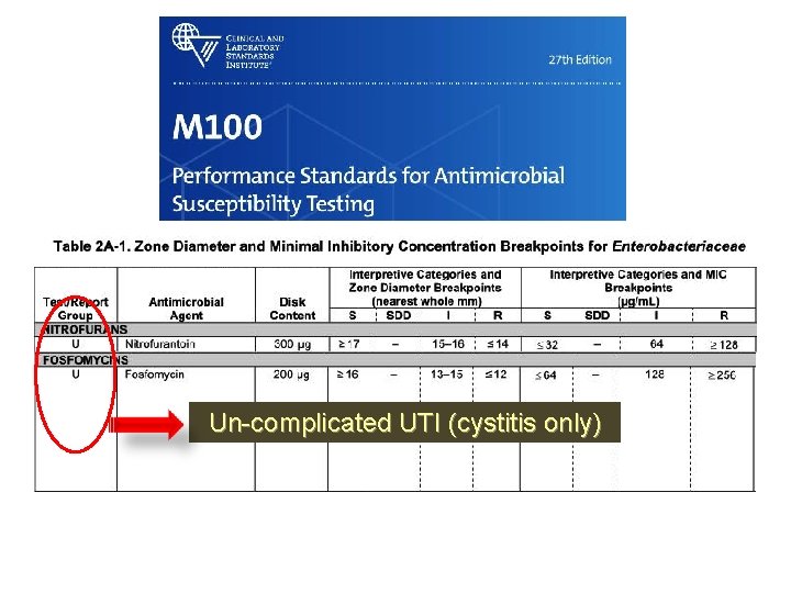 Un-complicated UTI (cystitis only) 