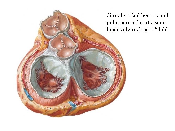 diastole = 2 nd heart sound pulmonic and aortic semilunar valves close = “dub”