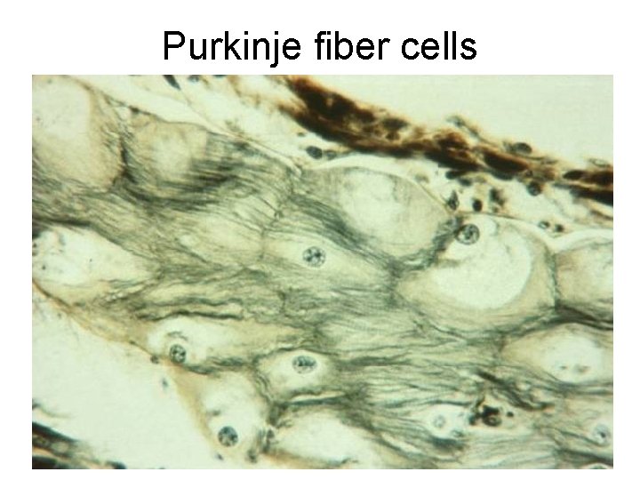 Purkinje fiber cells 