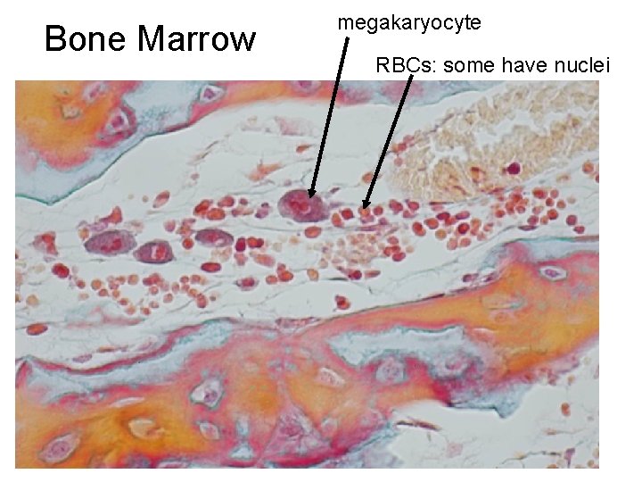 Bone Marrow megakaryocyte RBCs: some have nuclei 