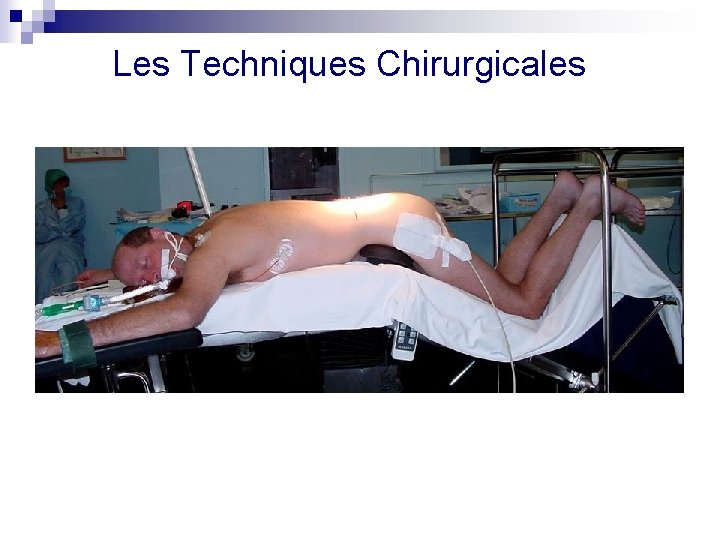 Les Techniques Chirurgicales 