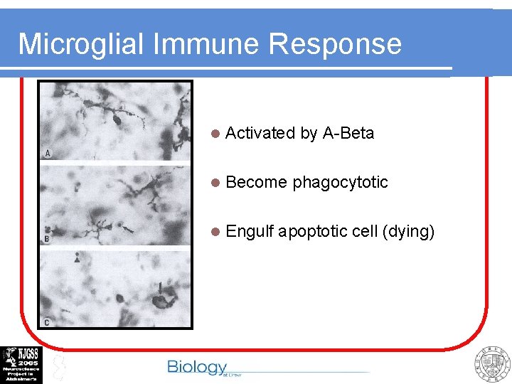 Microglial Immune Response l Activated by A-Beta l Become phagocytotic l Engulf apoptotic cell
