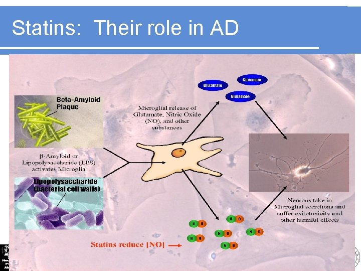 Statins: Their role in AD 